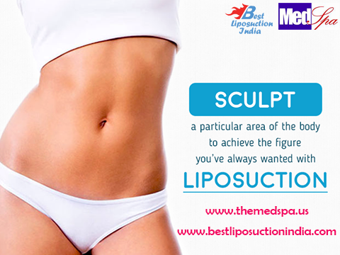 liposuction in Delhi