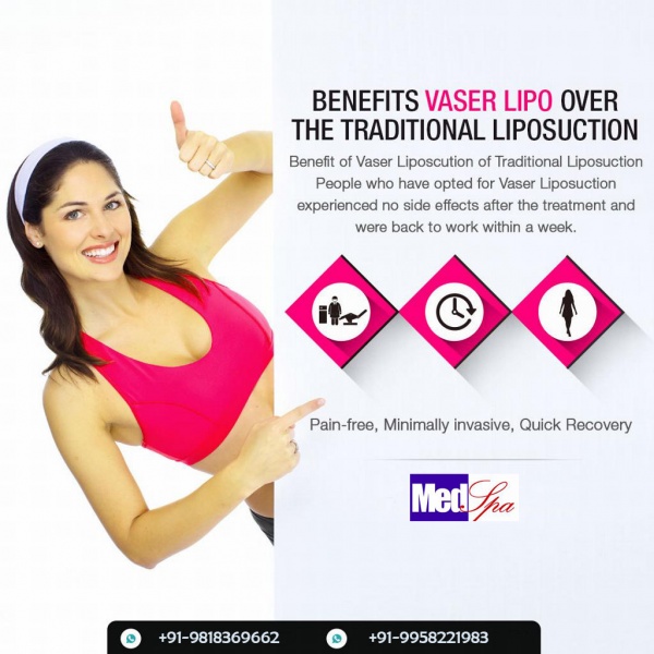 Different Types of Liposuction Procedures