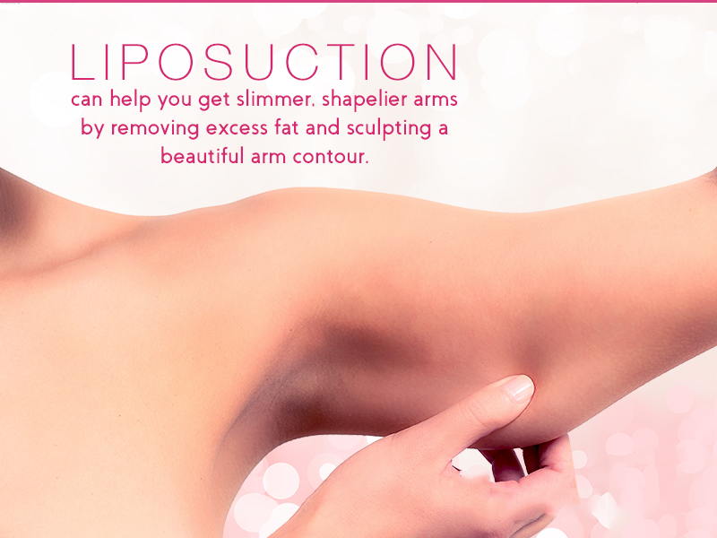 arm liposuction in Delhi