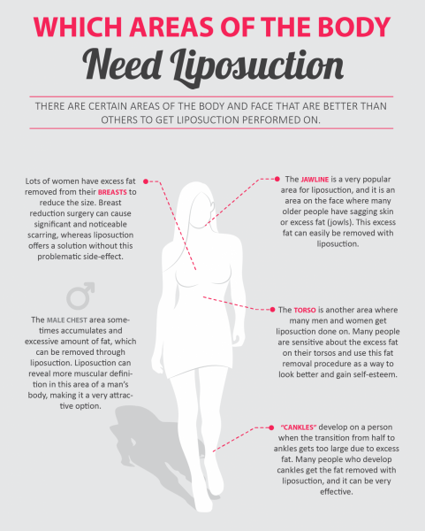 Best areas of your body to have liposuction