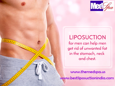 Liposuction for Removal of Excessive Fat from Patient’s Body for Weight Loss